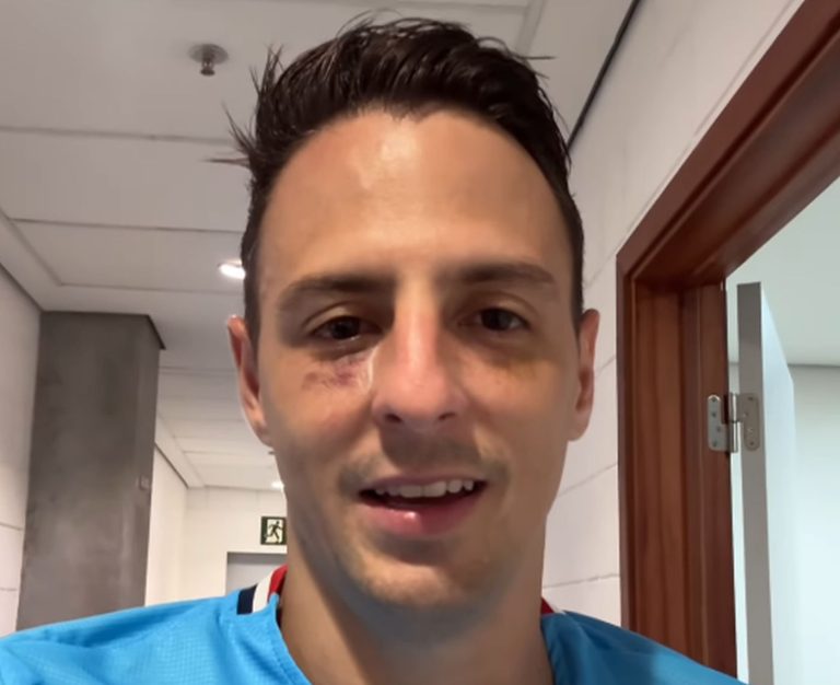 bahia arias marcas no rosto